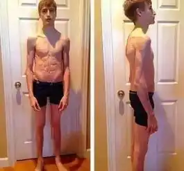 瘦出来的腹肌到底有多难看,看完你还急着拼命减肥吗