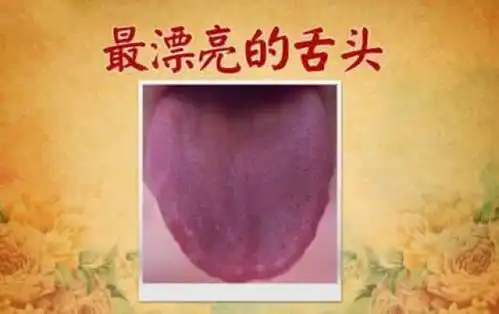 舌头上边的舌苔颜色不一样代表身体有病这种颜色一定要注意了