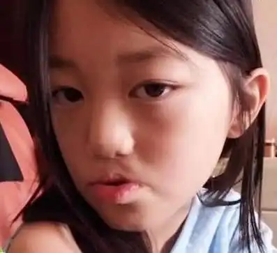可怜的李嫣7岁父母离异,14年来经历3次手术,如今美到认不出