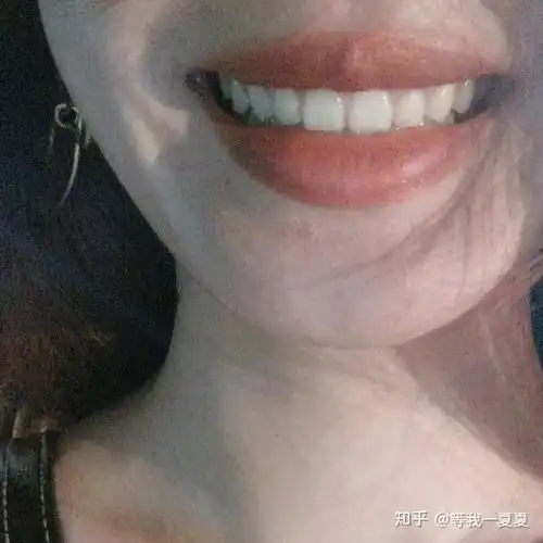为什么长期刷牙,牙齿还很黄