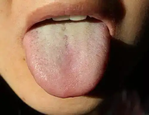 很多人有口臭自己却闻不到,不妨试试这些方法自测