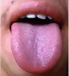 舌头是疾病的照妖镜,中医教你5招,通过舌诊看出疾病