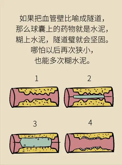 越来越多的年轻人猝死,如何预防和急救,专科医生详细讲给你听