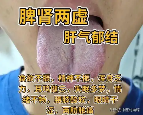 挑战全网搜寻120个舌象图在线回复,脾肾两虚,肝气郁结脾虚湿盛