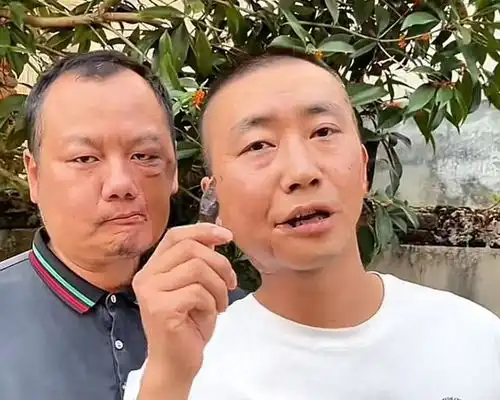 槟榔四巨头一天吃5包槟榔,两年死仨,剩下一个割舌保命