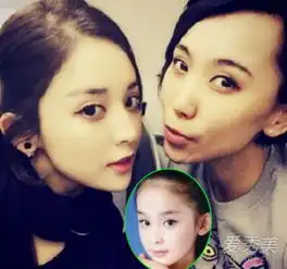 baby娜扎李冰冰躺枪兄弟姐妹揭秘整容真相