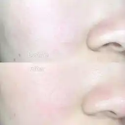 微安薇薇安对美白嫩肤面膜十城十美定制版使用效果的评价黑妹们有救了亲测好用的美白面膜化妆品yoka时尚网