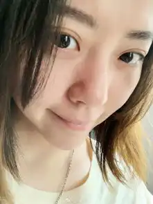 张靓颖素颜自拍皮肤白皙自夸就连长痘都可爱