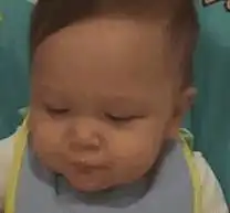 提起儿童性早熟,很多家长第一反应都是懵的