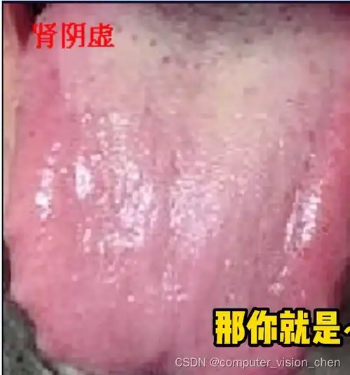 肾和膀胱中医笔记