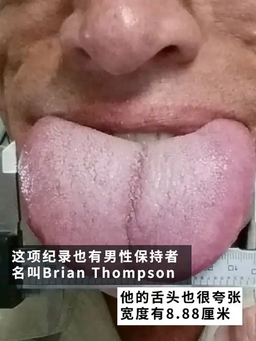 美国一姐姐拥有世界最宽的舌头一次性可吃四个棒棒糖