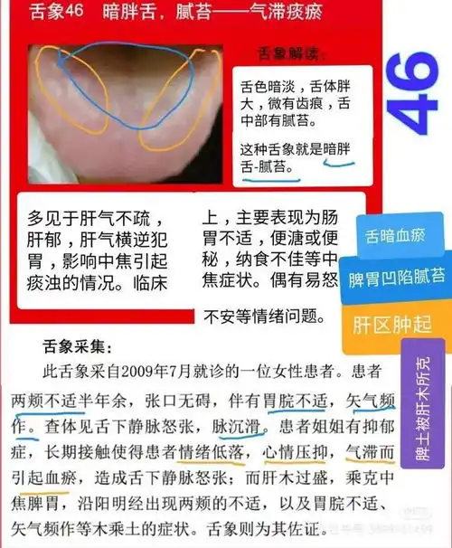 舌诊图,看着看着也学会了一点