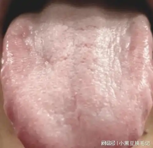 脾胃一虚百病来脾胃最怕的4种舌象,每个人都应该知道