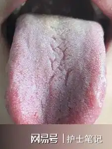 为什么海绵体会敏感
