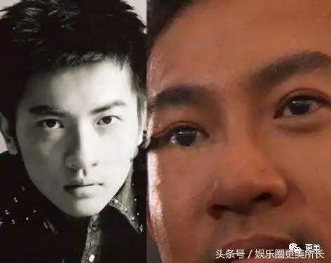 比起薛之谦的花边新闻,我更想知道他的肉条眼怎么解决