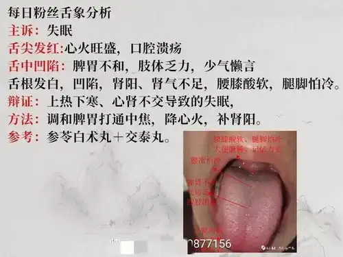 舌诊图,看着看着也学会了一点
