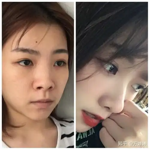 南京哪个整形医院比较好