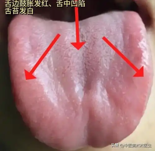 四种男性病症常见舌象中医教你观舌象,辨体质