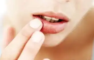 秋季嘴唇干裂脱皮秋季护唇怎么做