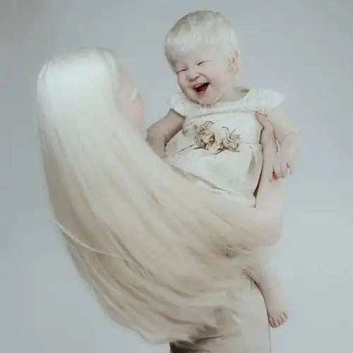 白化病姐妹罕见美照曝光,引6万粉丝赞叹看一眼就忘不掉