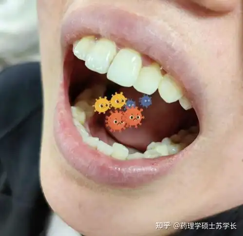 男生总是口臭,舌苔又厚又白咋办调理肠胃到底有没有用教你3招,一次性真正解决男士口臭问题