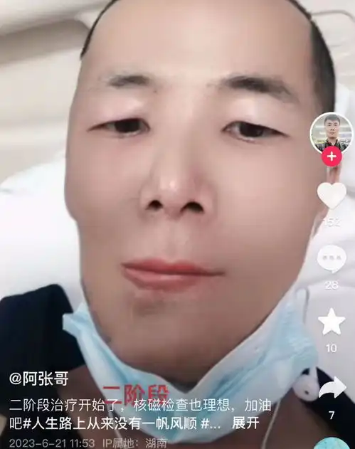 回顾槟榔四巨头两年死四个,一天狂炫3包槟榔,有一个割舌保命