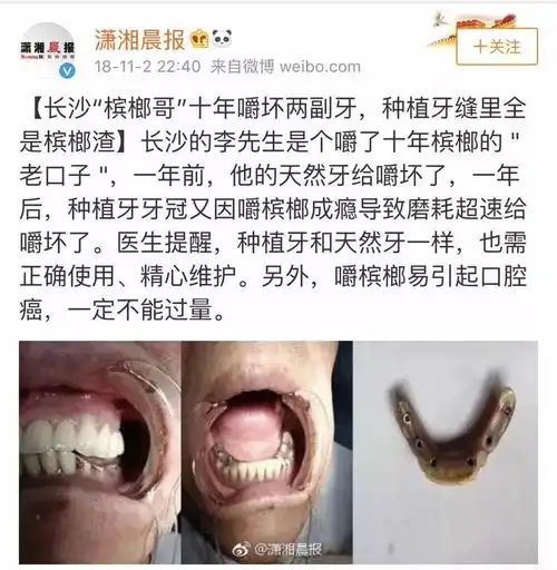 远离槟榔,守卫健康公益转发