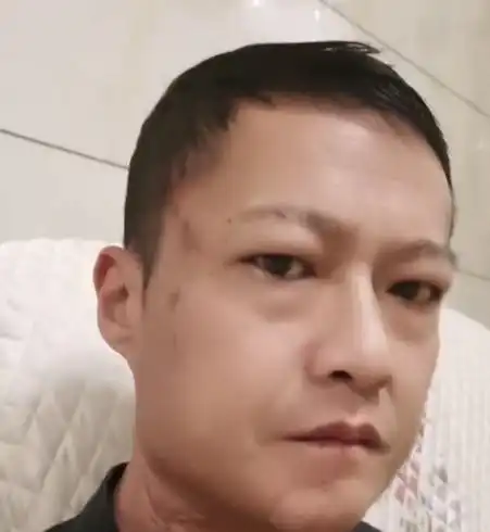 槟榔四巨头一天五包槟榔,两年走了3个,剩下一个割舌保命