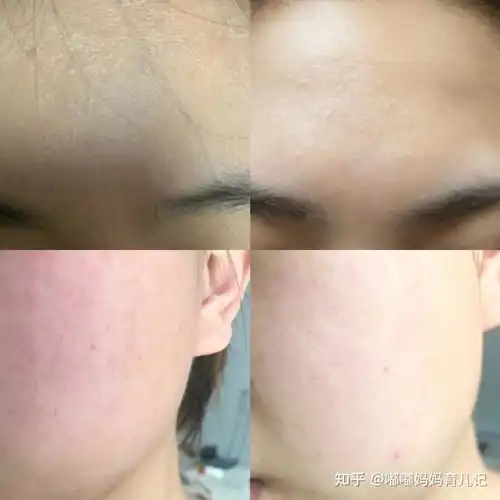 什么牌子的水乳适合孕妇用你不知道孕妇水乳信息差舒缓保湿控油增弹细腻五巨头,孕期护肤上岸总结