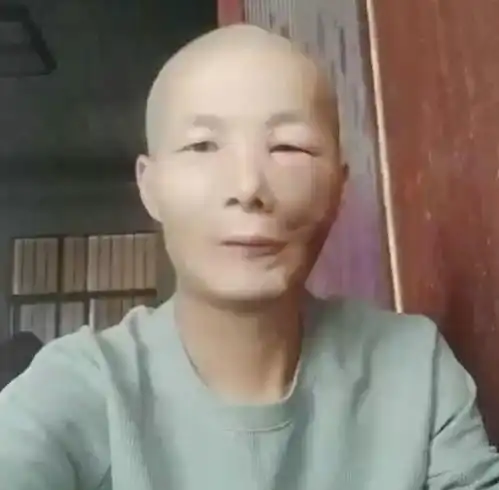 槟榔四巨头一天狂炫5包槟榔,两年死仨,剩下一个割舌保命
