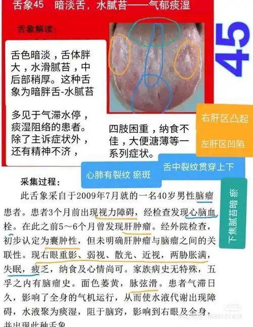 舌诊图,看着看着也学会了一点