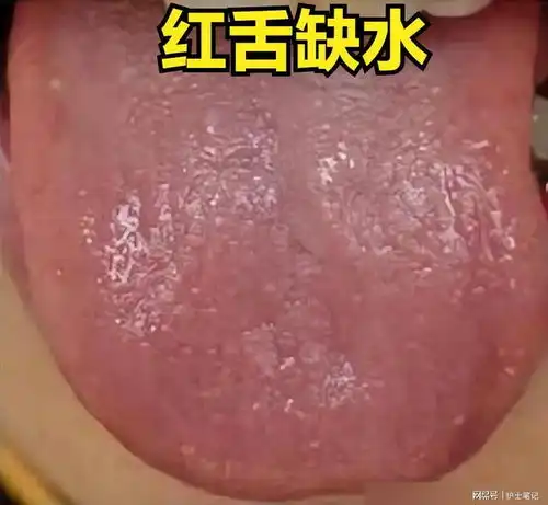 舌红缺水,舌白缺血,舌胖缺气,教你一招,一次补足气血精心火舌体手脚冰凉网易订阅