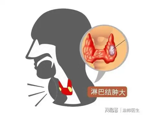 口腔溃疡久治不愈,警惕是口腔癌的信号,还有5个异常出现