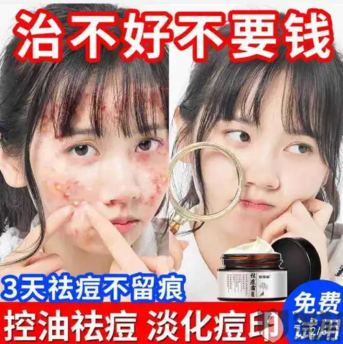 黑猫投诉凯丽阁化妆品旗舰店只能退半价,且做虚假广告宣传,假的说治不好不要钱