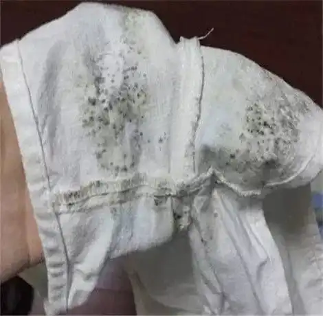 白衣服蟹黄怎么洗掉
