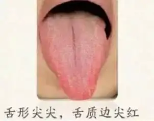 伸出舌头看一看,给你的身体健康做个小检查