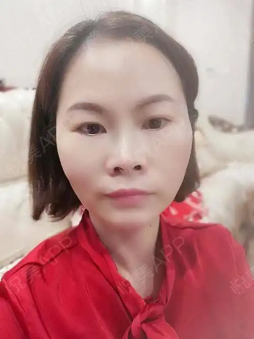 女人过了30以后,皮肤和脸就是自己掌控了,35岁更是关...紧致提升悦美整形