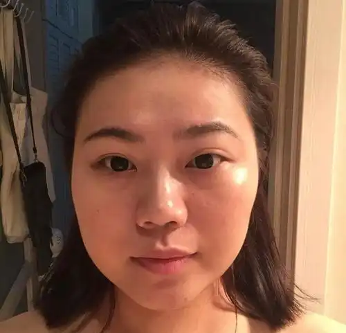 判断你是不是大小脸面部不对称是关键,看这几点就知道