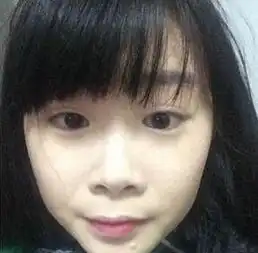 30岁的她满脸斑不敢出门,每天用点它20天祛斑