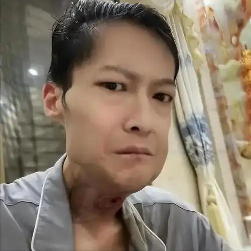 槟榔四巨头一天狂吃5包槟榔,两年死仨,剩下一个割舍保命