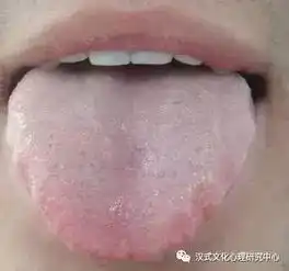 汉式养生舌诊图谱大全你也来学学