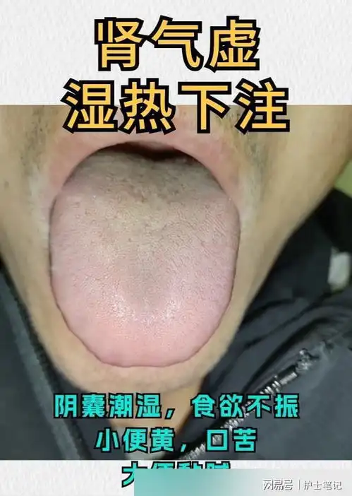 今天继续挑战全网收集舌象99个,你发我看,最快10分钟内出结果