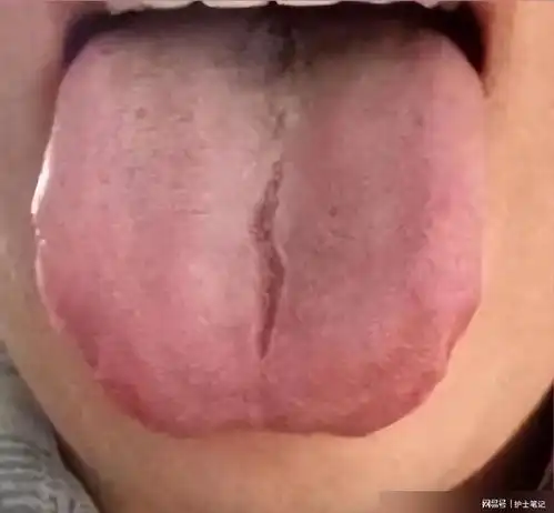肝郁气滞导致的宗筋不起,用了逍遥丸却没有效果,问题出在哪里