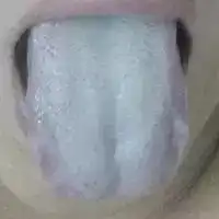 你知道自己是什么体质吗伸下舌头就知道了