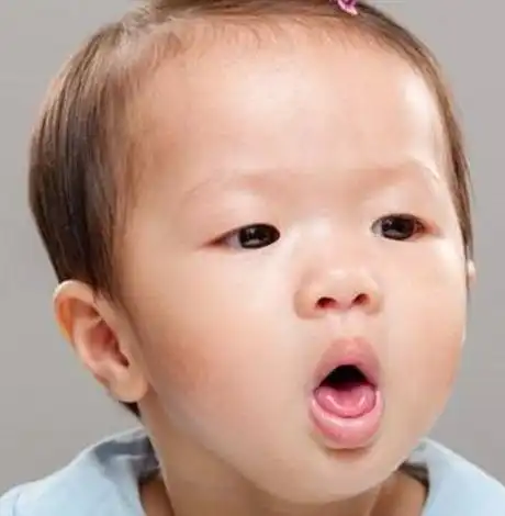 2岁宝宝咳嗽有痰呕吐发烧