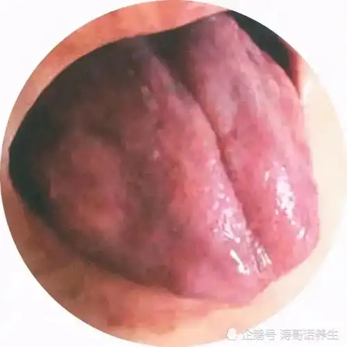 中医养生零基础学舌诊第一讲舌形和舌面