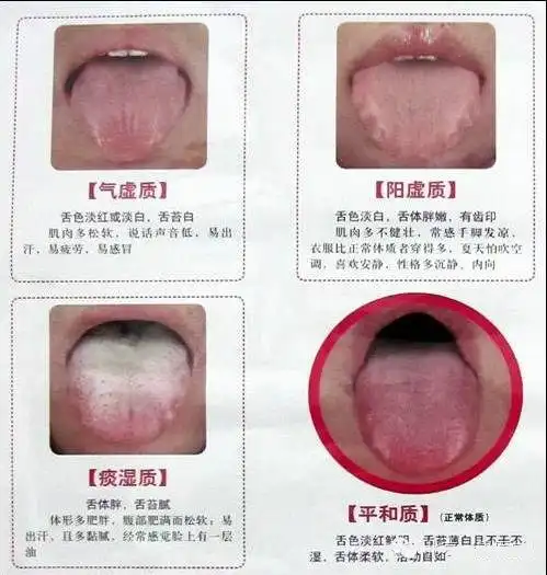 珍贵中医舌诊图解大全图文并茂,教您看肝胆脾胃心肺肾