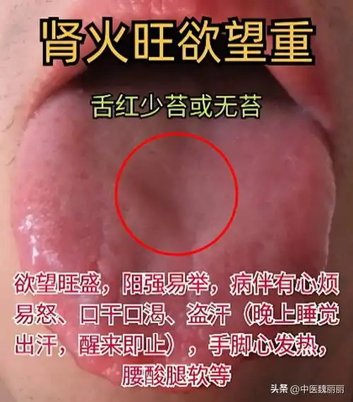 舌象挑战第11天,一舌一分析中气下陷,脾虚,肝气郁结,心气虚