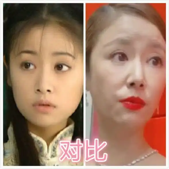 林心如晒无滤镜自拍直面皮肤缺陷,自嘲有法令纹和双下巴但纯天然