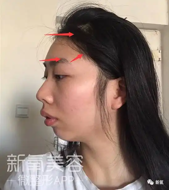 网友地铁偶遇刘雯,没想到亚洲超模生活中穿得